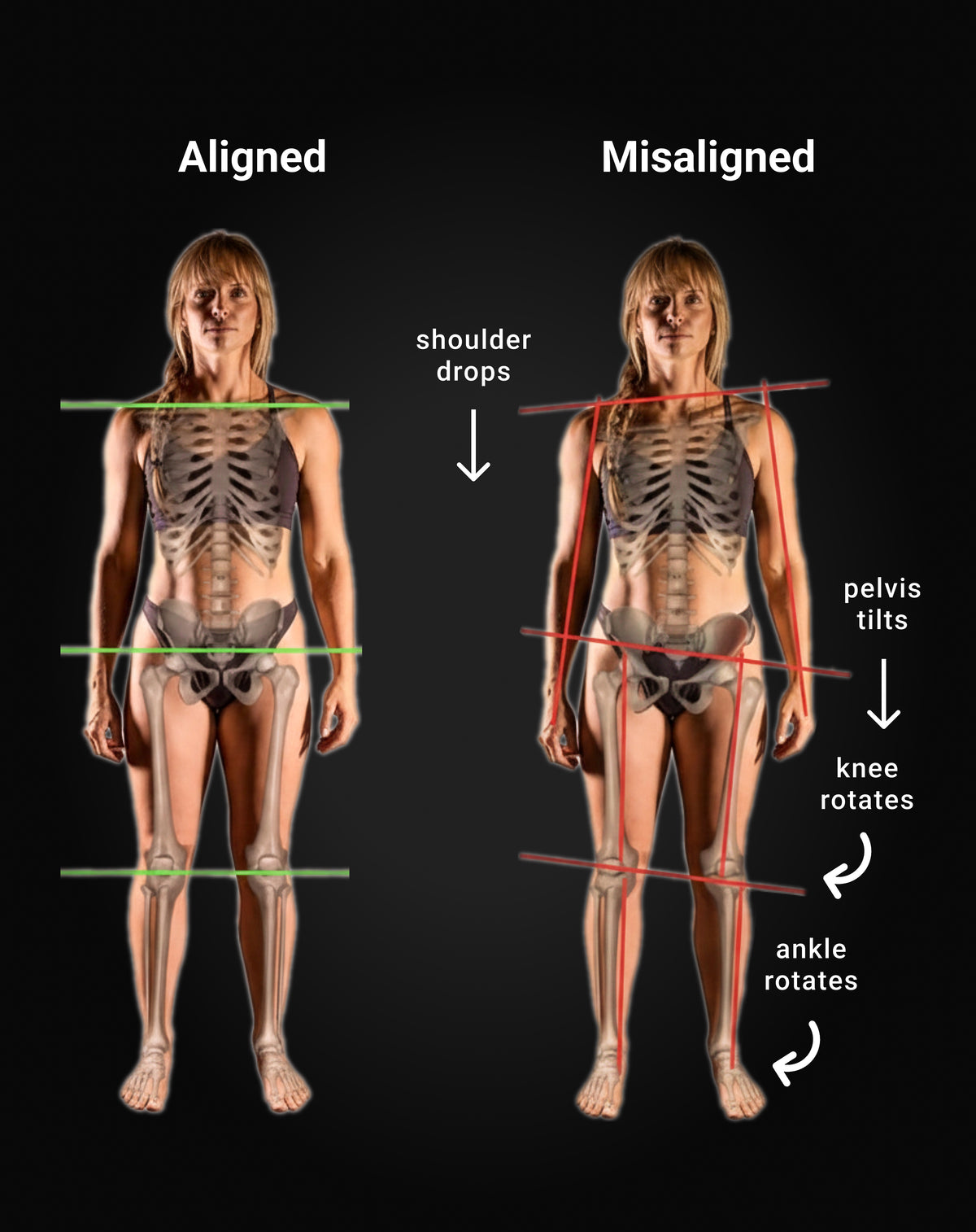Hips Aligned The Mark: A New Hip Hook by Aletha Health
