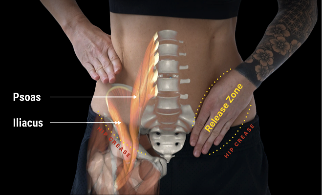 Psoas_Iliacus.png